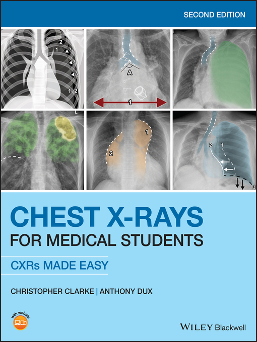 Title details for Chest X-Rays for Medical Students by Christopher Clarke - Available